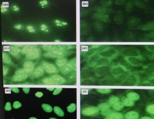 Immunofluorescence Microscope 1