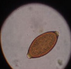 Parasitology Image